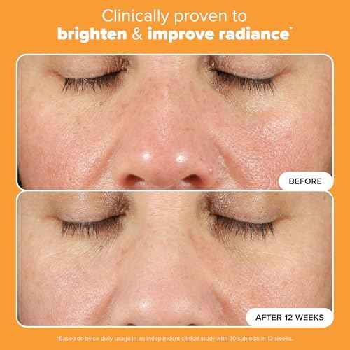 Paula's Choice BOOST C15 Super Booster, 15% Vitamin C Serum for Face, Face Serum with Vitamin E & Ferulic Acid for Discoloration & Glow, Fragrance-Free, 0.67 Fl Oz