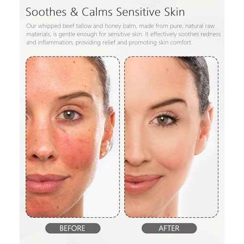 Beef Tallow for Skin (4 OZ), Whipped Beef Tallow and Honey Balm, Tallow Face Moisturizer, Grass Fed Beef Tallow for Face and All Skin Types