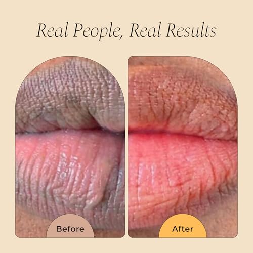 Glo Melanin Lemon & Turmeric Lip Balm 1 Pack - Brighten & Nourish Dark Lips