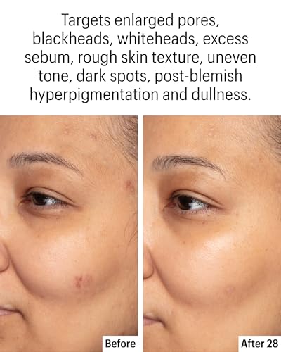 Allies of Skin Azelaic & Kojic Face Serum for Clear Skin - 1 Fl oz