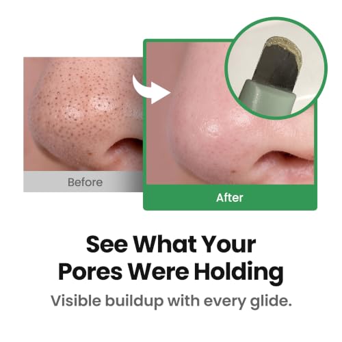 ilso Deep Clean Master - Sebaceous Filament Pore Care Tool