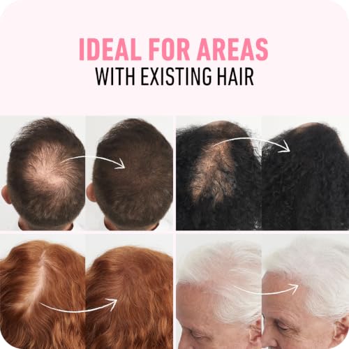 Boldify Hair Fibers for Thinning Hair - Black, 28g, Vegan & Water-Resistant