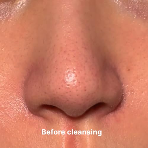 Aloe Fermentation Cleansing Oil, Hydrating and Gentle Cleanser, Makeup Blackhead Remover, Olea Europaea (Olive) Fruit Oil, All Skin Types, Korean Skin Care 6.7 fl.oz. / 200ml