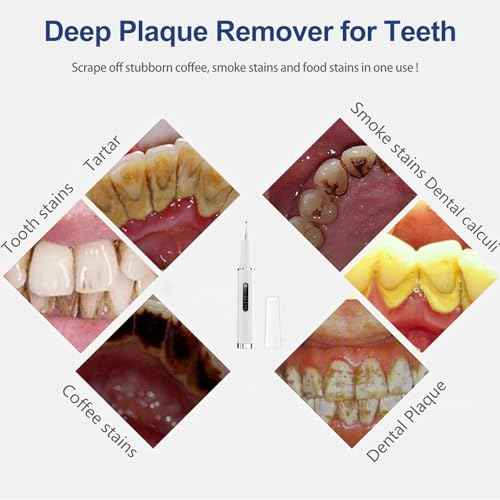 Professional Plaque Remover for Teeth, Teeth Cleaner Tool with Intelligent and Secure Sensor Technology, 4 Replaceable Heads 5 Modes, OLED Light & Oral Mirror, Rechargeable Teeth Cleaning Kit For Home