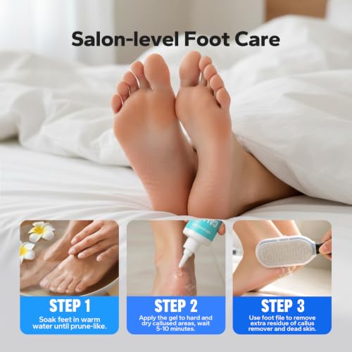 SilkySecret Callus Remover Gel for Feet - Extra Strength Foot Softening & Cracked Heel Treatment