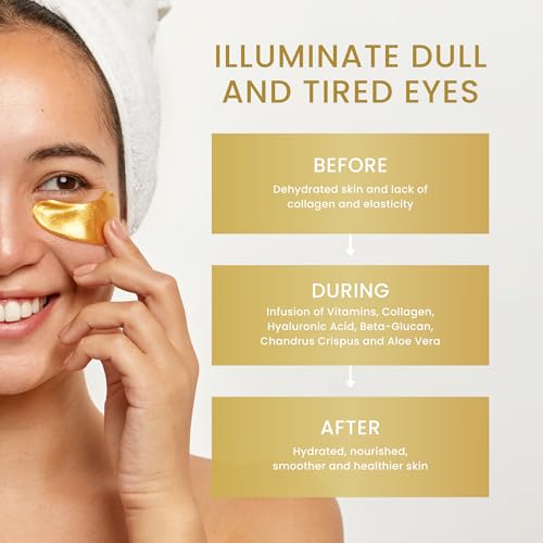 Bisou Bisou Bisou 16 Pairs Gold Under Eye Patches with 2 pieces of Lip Mask | Under Eye Mask Dark Circles and Puffiness | Wrinkles Patches with Hydrogel | Collagen Eye Pad