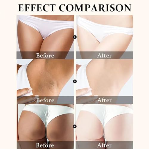 Crema para Aclarar las Axilas y Partes Intimas, Eliminador de Manchas Oscuras para la Cara, Crema Aclaradora para ?reas ?ntimas, Cuello, Axilas, Codos, Muslos Internos y Rodillas