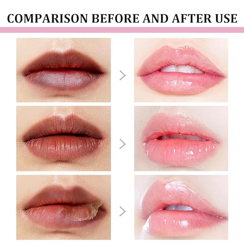 Natural Lip Lightening Balm for Smokers - Moisturizer & Repair