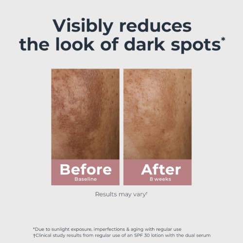 Eucerin Radiant Tone Dark Spot Serum with Thiamidol