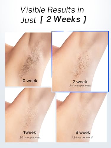 Blex Laser Hair Removal Device Blue - IPL Hair Removal for Women & Men, Fast & Painless, Permanent Results
