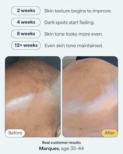 Vitamin C & Dark Spots Serum Duo by Remedy Science | 2 x 1 fl oz