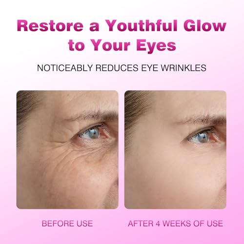 Retinol Eye Stick | Anti-Aging, Reduce Wrinkles & Puffiness