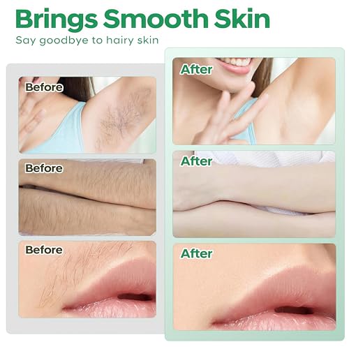 40pcs wax strips - Body Waxing Strips, Wax Kit for Women & Men - Brazilian Wax Kit, Back Waxing Kit, All Skin Types, Arms, Legs, Armpits, Bikini, 98% Natural, Hypoallergenic Odourless, Green
