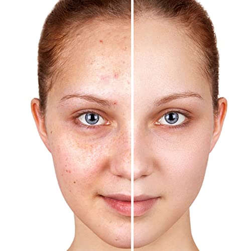 Boobeen Full Coverage Foundation - Liquid Matte Concealer