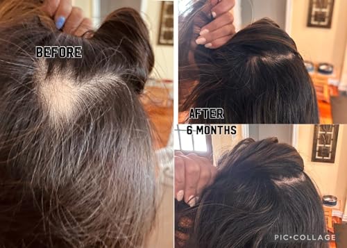 Multi-Peptide Hair Growth Serum with Biotin & Castor Oil - 1oz