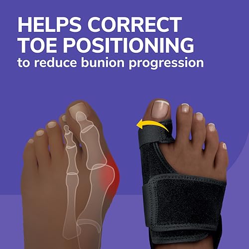 Dr. Scholl's Bunion Relief & Toe Corrector Splint