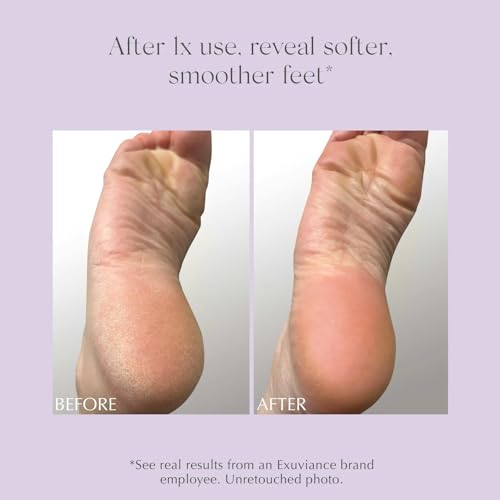 EXUVIANCE Exfoliating & Conditioning Foot Balm - 20% AHA/PHA, 1.7 oz
