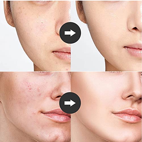 High Frequency Facial Wand with 4 Tubes