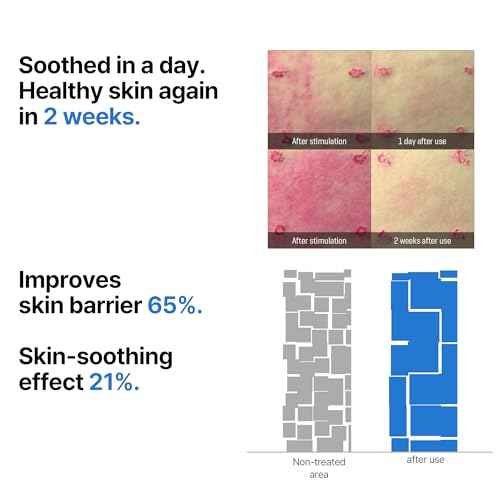 SOME BY MI Beta-Panthenol Repair Serum ? 1.01oz, 30ml ? Korean Hydrating Hyaluronic Acid Serum for Face ? Daily Barrier Repair & Soothing Formula with Beta-Sitosterol & Panthenol ? Korean Skin Care