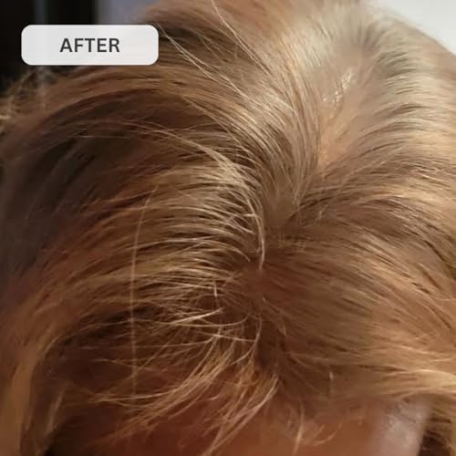Kiierr 272 MD Laser Cap | FDA-Cleared Hair Loss Treatment
