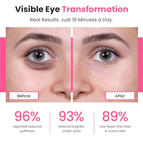 Eye Revitalize ? Red Light Therapy for Dark Circles & Eye Bags