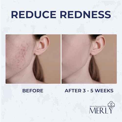 Merly¢â Disposable Face Towels, Facial Wipes Towelettes Disposable, Towels Cloth For Cleaning Face, 10"x12", 50 Counts, 1 pack, Ultra-Soft, Super Absorbent, Biodegradable