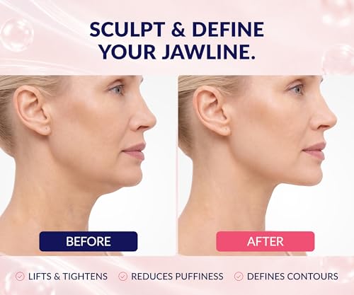 Stylia V Line Lifting Collagen Mask - Double Chin Reducer (10 Pack)