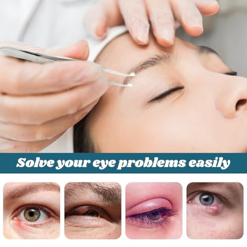 JIANWEI Meibomian Gland Expressor, Eyelid Gland Blockage Unblocking Physiotherapy Tools, Professional Forceps Stainless Steel Eyelid Massage Tweezers for Dry Eyes (Round Tip)
