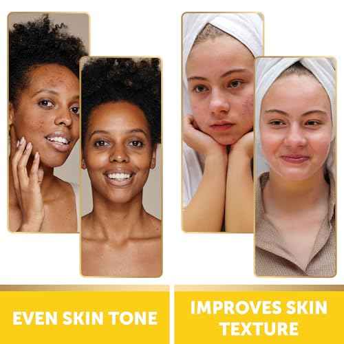 VALITIC Turmeric Kojic Acid Cleansing Pads - Exfoliating Dark Spot Remover for Face with Vitamin C, Alpha Arbutin, Niacinamide and Retinol - Kojic Acid And Turmeric Cleansing Pads - 60 Units