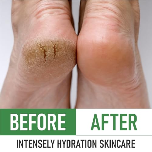 PurOrganica Urea 20% Foot Cream for Cracked Heels & Calluses - Made in USA