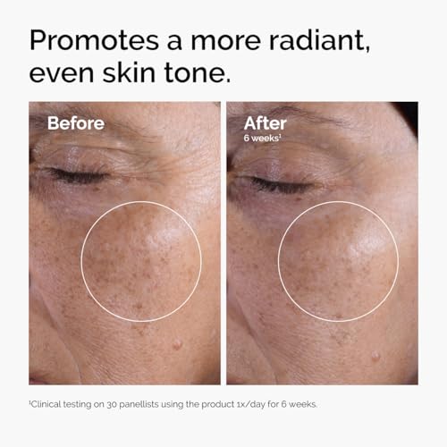 The Ordinary Glycolic Acid 7% Exfoliating Toner Pack of 2 - Brightening, Smoothing, 8.1 Fl Oz Each