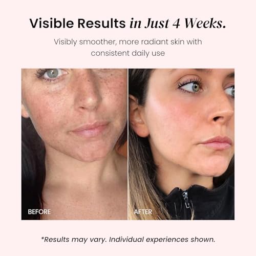 6 in 1 Multi Purpose Moisturizing Balm ? Fades Fine Lines and Wrinkes- Ultra Hydrating, Calming and Glow-Boosting Treatmen ? Multi Benefit Daily Balm for All Skin Types