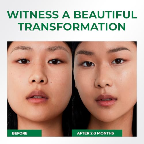 Rice Toner for Face, 82% Rice Extract with Hyalyronic Acid, Niacinamide and Centella Extract - Hydrating for Dry, Dull, Combination Skin, Vegan, Fragrance Free, Glass Skin