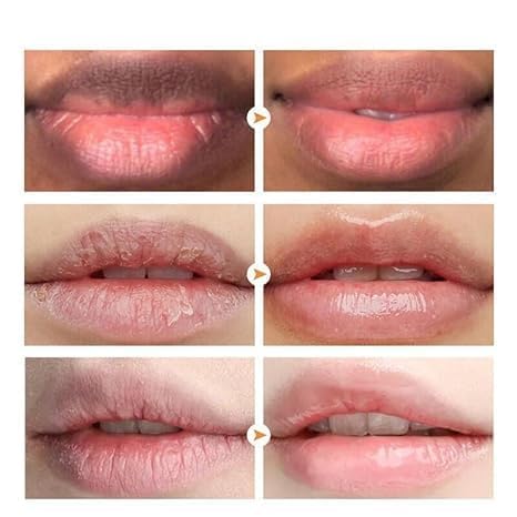 Dark Lip Lightening Balm – Moisturizing & Hydrating for Men Women