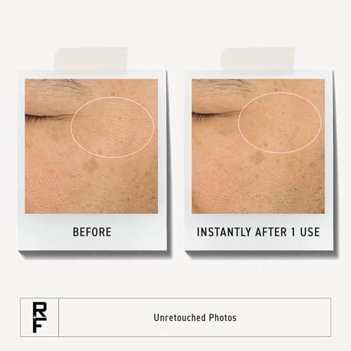 RODAN + FIELDS Hydra Mask Gel Cream | Lightweight Overnight Hydration Treatment with Hyaluronic Acid, Peptides & Electrolytes | Moisturizing Gel Cream for All Skin Types | 1.7 oz