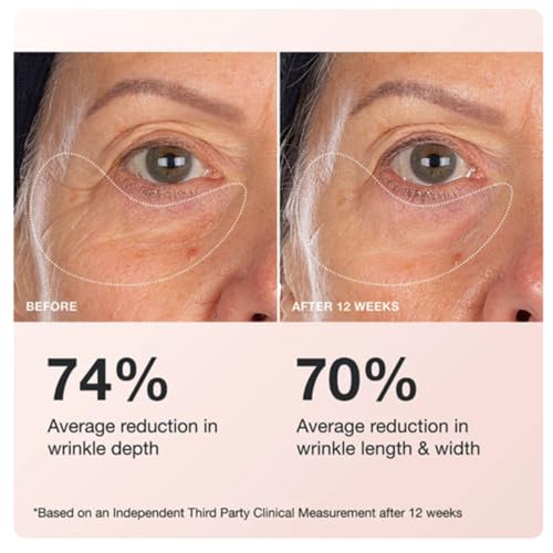 Innbeauty Project Extreme Cream Eye Firming & Contouring Eye Cream with Peptides & Botanicals, Refillable 0.5 OZ (15ml)