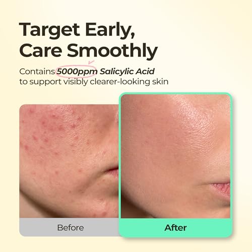 BHA Iconic Spot Patch with Mirror Case - Hydrocolloid Patches with 5,000ppm Salicylic Acid - Day & Night Zit Patch for Targeted Sebum Care & Stylish Wear