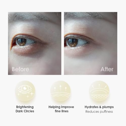 Sweet Dreams Collagen Glow Gold Eye Masks l Korean Under Eye Patches Puffy Eyes, Dark Circles & Wrinkles | Collagen, Niacinamide, Hyaluronic Acid & Peptides | Hydrating Eye Treatment& Self Beauty Care