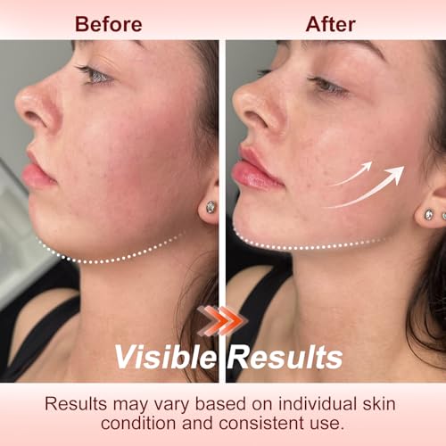 Face Lifting Facial Massager, Face Massager Tool with Suction, 7 Colors Red Light Therapy Face Lift Device for Skin Tightening Wrinkle & Lifting