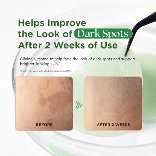 Matcha Face Toner Pads for Dark Spots, Acne-Prone & Dull Skin, Hydrating Facial Toning Polish Pad Recovery & Refining with Rose PDRN, Peptides & Hyaluronic Acid, Korean Skin Care, 100 Pads (1 Pack)