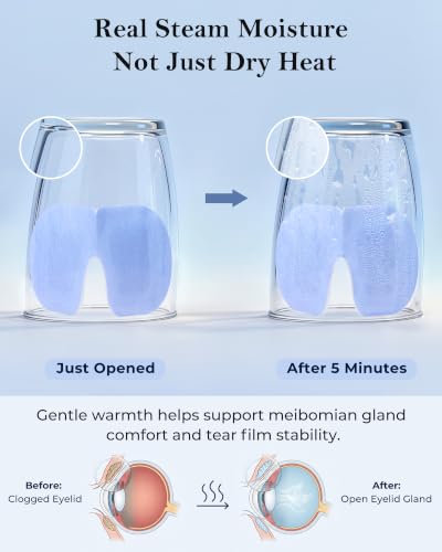 16-Pack Self-Heating Steam Eye Mask for Dry Eyes