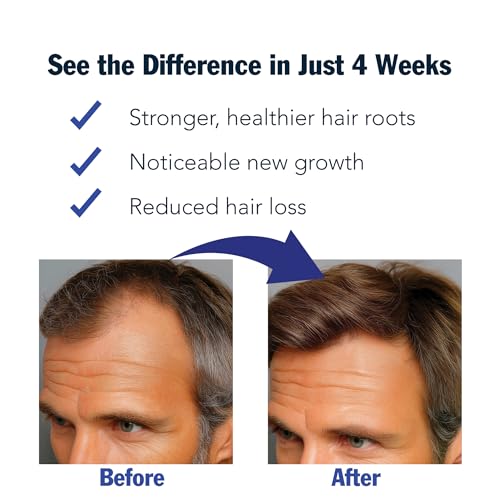 Redensyl Hair Growth Serum Roll-On for Thicker Hair - 30ml, DHT-Blocker, Natural Follicle Revitalizer