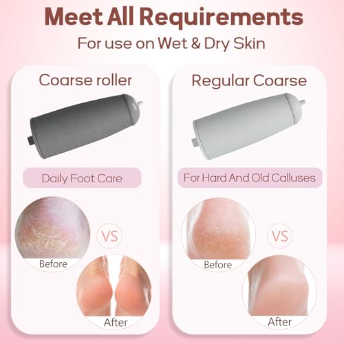 ZABOUL Electric Foot Callus Remover - Rechargeable Electronic Foot File