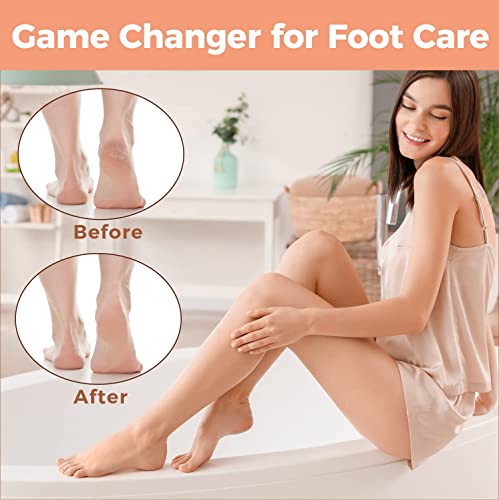 Foot File Foot Scrubber Pedicure - Callus Remover for Feet Easkep Professional Grater Rasp Foot Scraper Corns Callous Removers Cracked Dead Skin Remover for Dry and Wet Feet