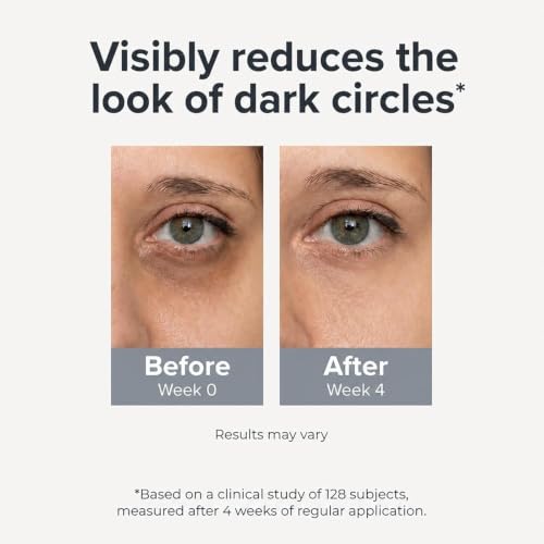 Caffeine & Retinol Eye Roller - Dark Circles & Puffiness Relief