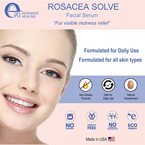 E70 Rosacea Serum - Redness Relief Serum For Rosacea and Acne-Prone Skin - Skin Care With Beneficial Ingredients, Aloe Vera, Hyaluronic Acid, Almond Oil, Licorice & Chamomile Extracts - No Parabens