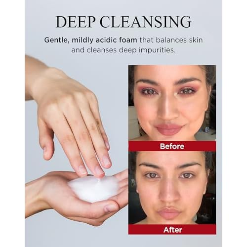 Bonyongo Red Ginseng Vinegar Foam Cleanser ? Low pH Micro-Dense Face Wash, Removes Makeup Without Stripping ? Fermented Red Ginseng + Hinoki Water, Nourishing & Hydrating 4.05 fl oz