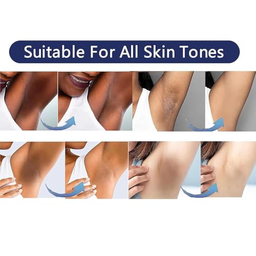 Skin Lightening Cream for Intimate Areas & Body - 1 FL OZ