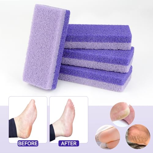 Glass Foot Pumice Stone 4-Pack - Double Sided Callus Remover & Scrubber