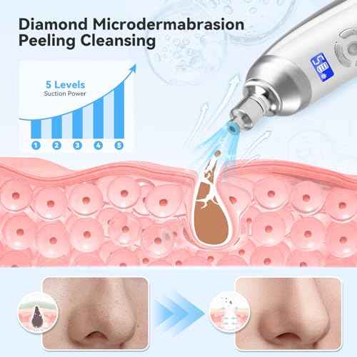 Upgraded Diamond Micro-Dermabrasion Facial Machine, Professional Facial Deep Cleasing Tool, Home Use Facial Skin Care Equipment